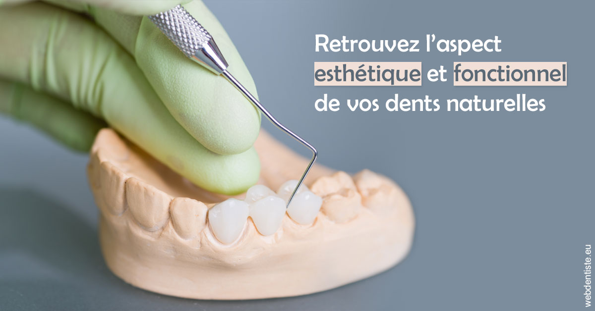 https://dr-francois-vergez.chirurgiens-dentistes.fr/Restaurations dentaires 1