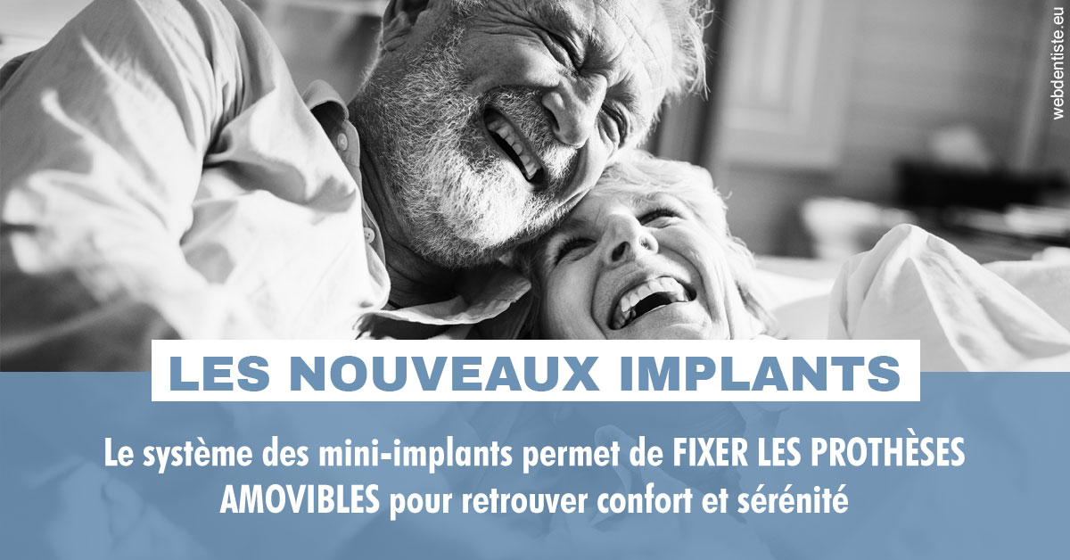 https://dr-francois-vergez.chirurgiens-dentistes.fr/Les nouveaux implants 2