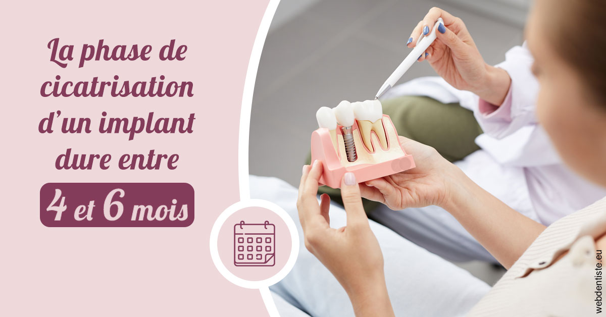 https://dr-francois-vergez.chirurgiens-dentistes.fr/Cicatrisation implant 2