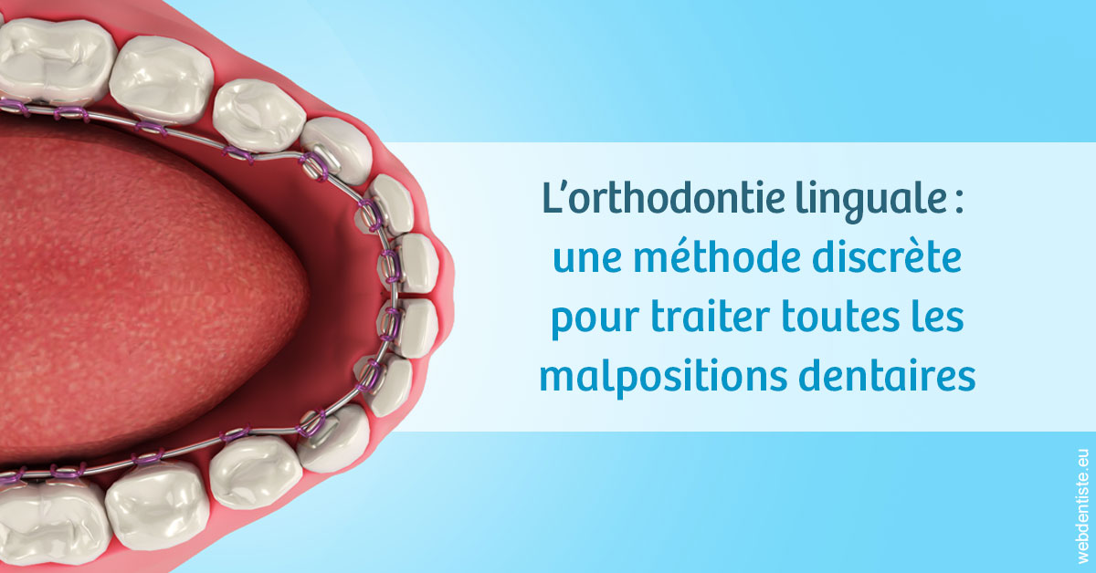 https://dr-francois-vergez.chirurgiens-dentistes.fr/L'orthodontie linguale 1