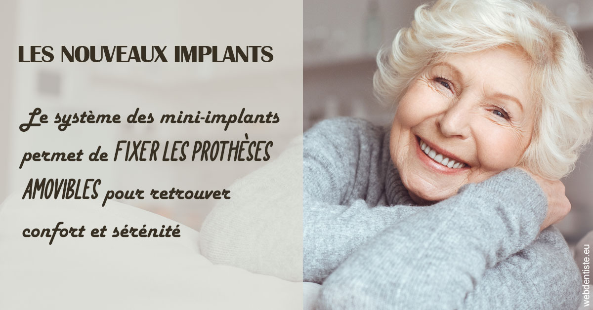 https://dr-francois-vergez.chirurgiens-dentistes.fr/Les nouveaux implants 1