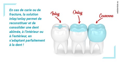 https://dr-francois-vergez.chirurgiens-dentistes.fr/L'INLAY ou l'ONLAY