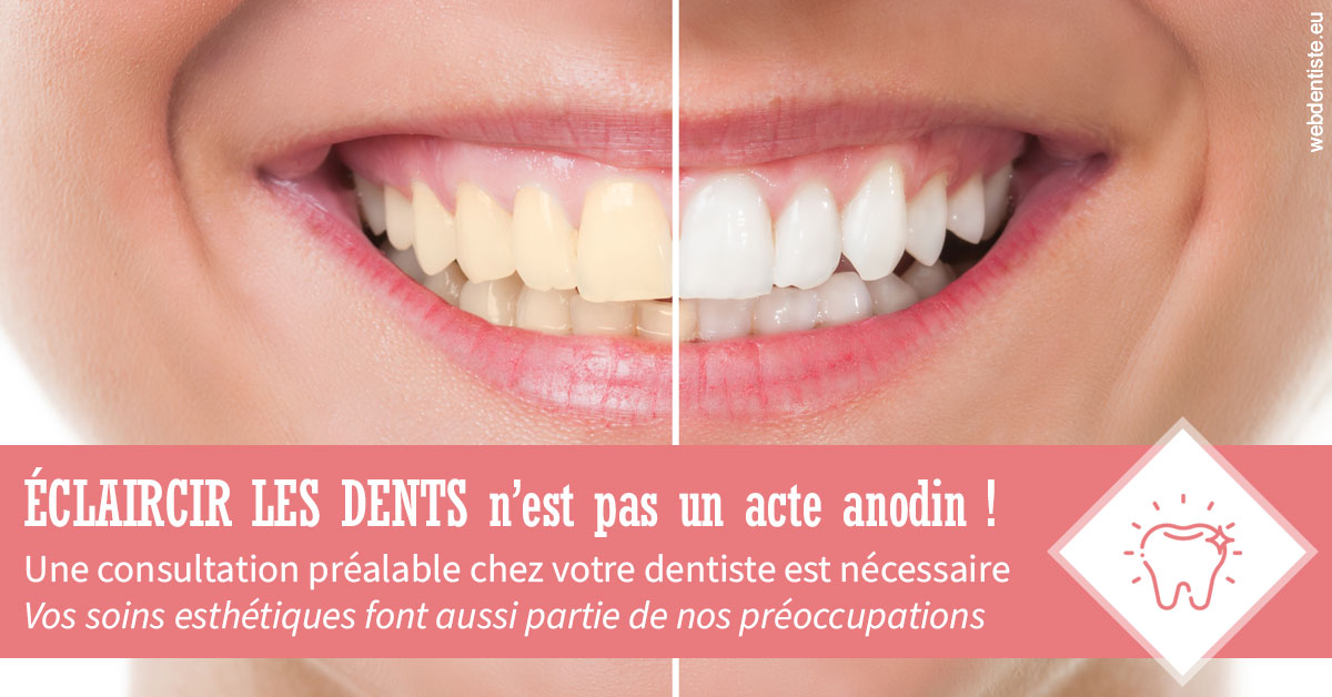 https://dr-francois-vergez.chirurgiens-dentistes.fr/Eclaircir les dents 1