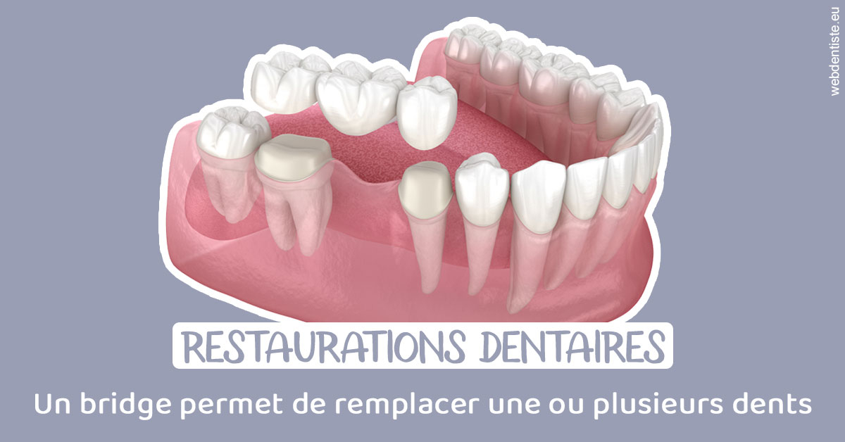 https://dr-francois-vergez.chirurgiens-dentistes.fr/Bridge remplacer dents 1