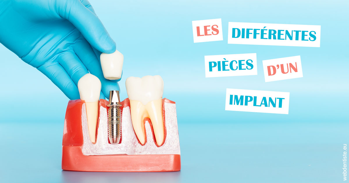 https://dr-francois-vergez.chirurgiens-dentistes.fr/Les différentes pièces d’un implant 2