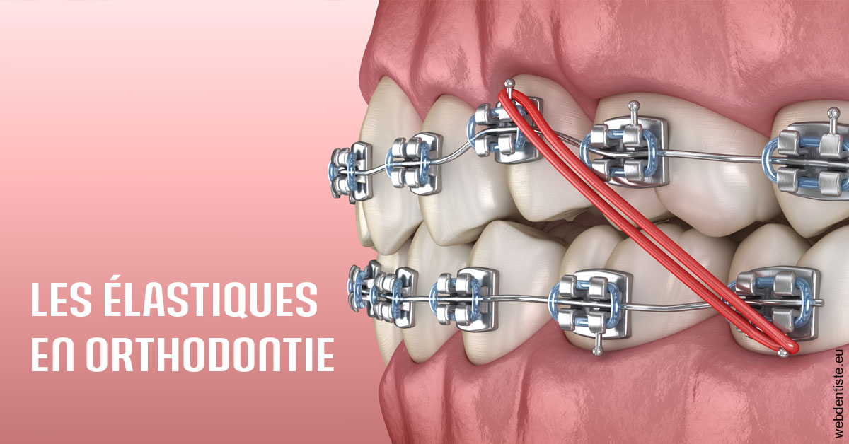 https://dr-francois-vergez.chirurgiens-dentistes.fr/Elastiques orthodontie 2