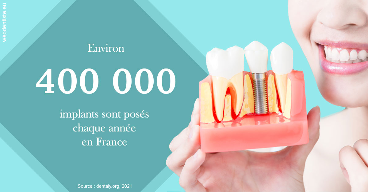 https://dr-francois-vergez.chirurgiens-dentistes.fr/Pose d'implants en France 2